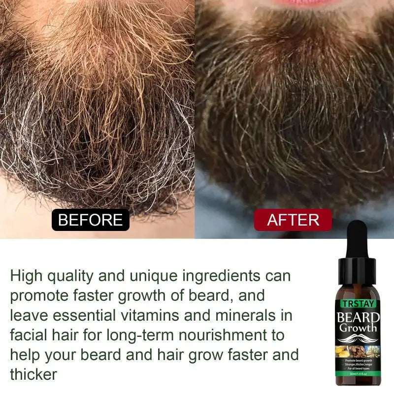 NEW Beard Hair Growth Essential Oil Anti Hair Loss Product Natural Mustache Regrowth Oil for Men Nourishing Beard Care