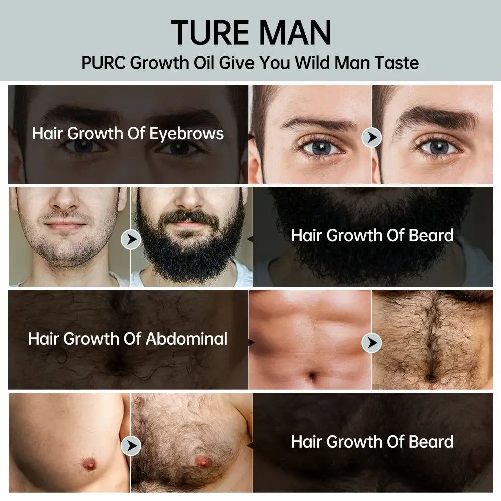 PURC Beard Growth Oil Hair Growth Products for Men Rosemary Oil Beard Fast Regrowth Nourishing Enhancer Treatment Hair